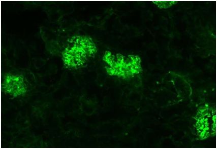 Science：細胞毒性T細胞竟讓<font color='red'>自身免疫疾</font>病更加嚴重！