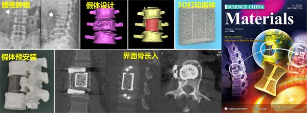 高強韌多孔<font color='red'>鈦合金</font>人工骨材料研發取得突破