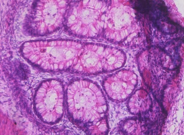 Cell Stem Cell：科學(xué)家利用畸胎瘤成功衍生出<font color='red'>肌肉</font>干細胞