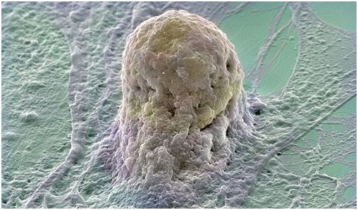 厄運不斷，CRISPR/Cas9基因編輯竟導致大片段DNA缺失和重排