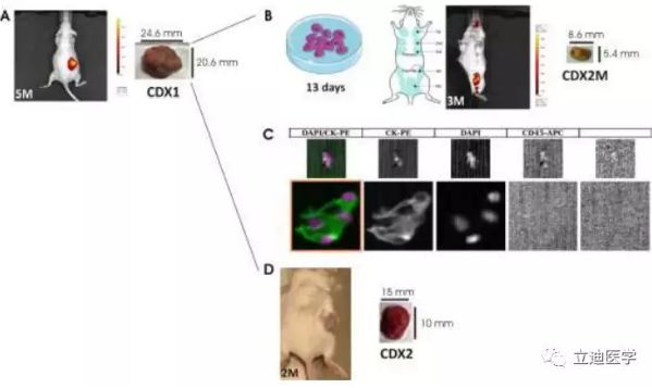 最新研究：科學家借助<font color='red'>循環腫瘤細胞</font>移植模型揭示三陰性乳腺癌的轉移機制