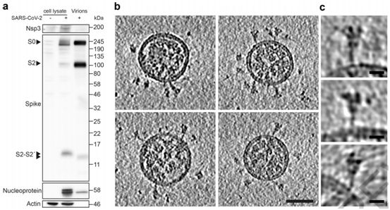 Nature全文編譯！揭示新冠病毒刺突蛋白在完整病毒顆粒上的結構和分布