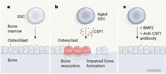 《Nature》重磅！衰老的骨骼干細胞會延緩骨折愈合,并促進炎癥發展加速全身衰老！