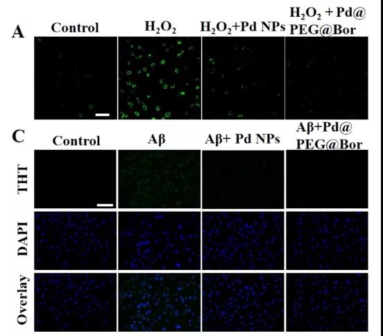 圖注：Pd@PEG@Bor消除活性氧并使體外Aβ含量下降