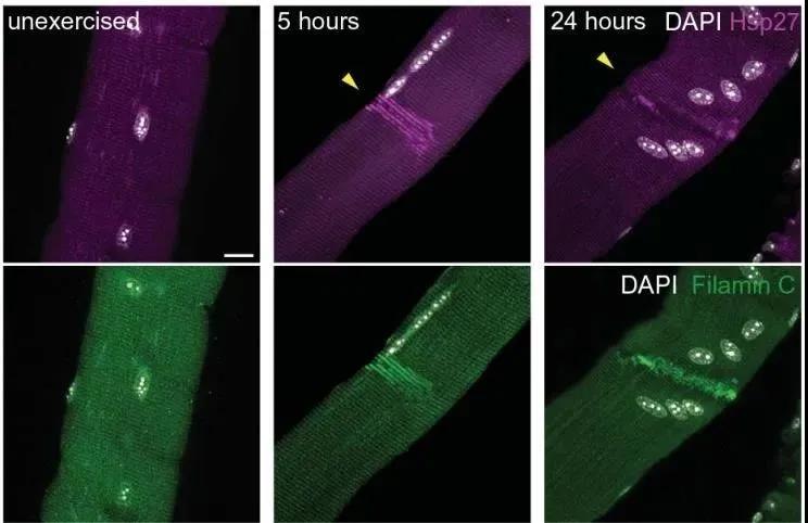 圖注：肌肉損傷后，HSP27（上）和FLNC（下）在受損區域的聚集情況