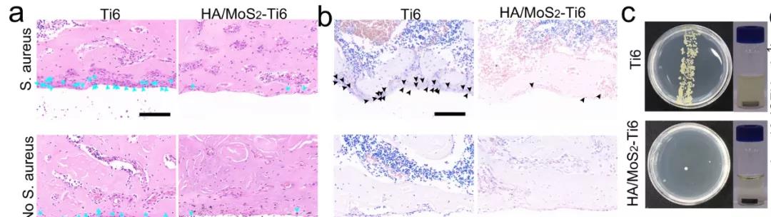 圖注：HA/MoS2-Ti6種植體的體內抗菌效果