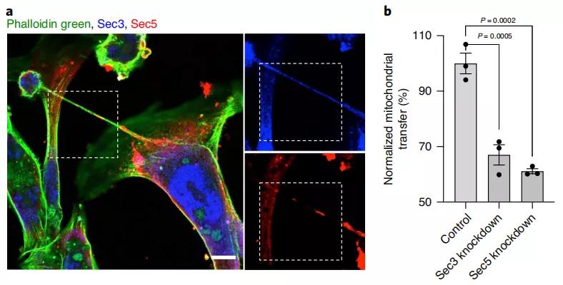 乳腺癌細胞和免疫細胞共培養(yǎng)的免疫標記，Sec3和Sec5與肌動蛋白細胞骨架共定位（Sec3藍色，Sec5紅色，肌動蛋白染色為球藻綠），缺少Sec3或Sec5可以減少免疫細胞和癌細胞之間的線粒體運輸