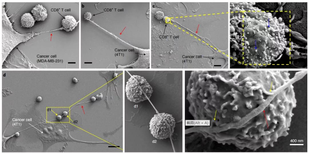 癌細胞和免疫細胞通過納米管狀結(jié)構(gòu)物理連接