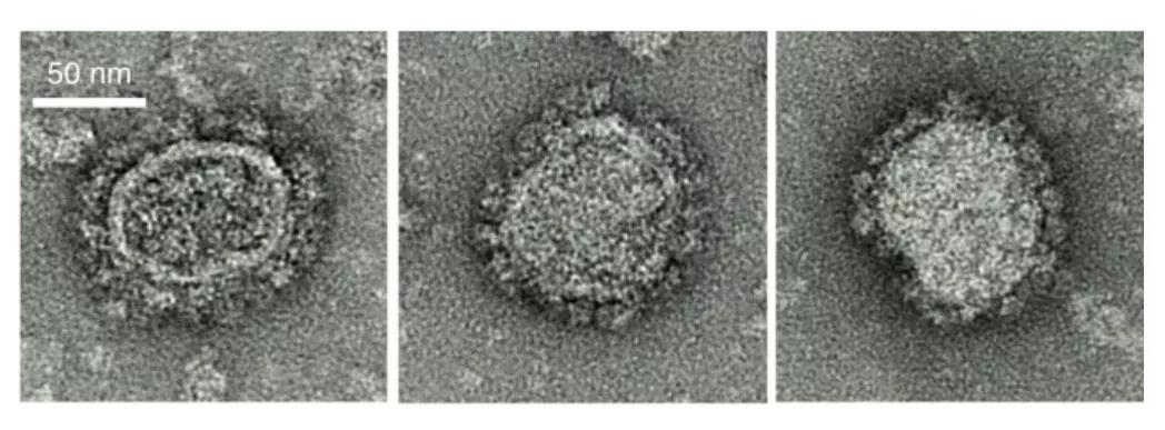  三種代表性 mRNA 表達的 Env-Gag VLP