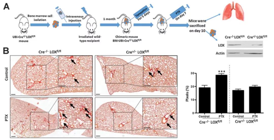 骨髓LOX缺陷嵌合小鼠的構(gòu)建示意圖以及PTX處理后肺組織膠原蛋白和彈力蛋白染色（圖源：Cancer Research）
