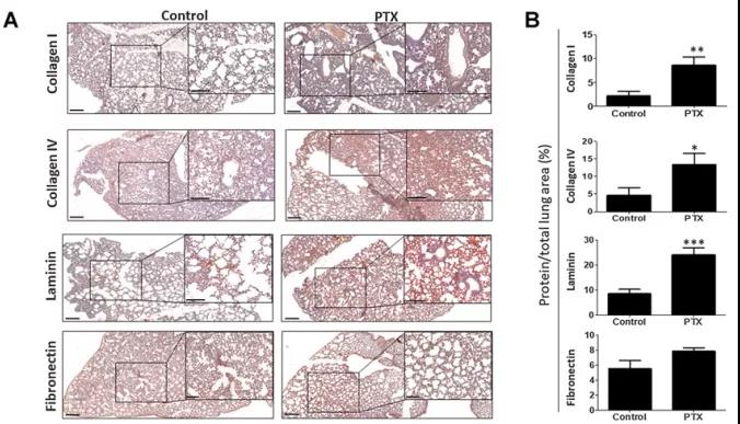免疫組織化學(xué)染色顯示PTX處理后小鼠肺組織ECM主要成分表達(dá)變化（圖源：Cancer Research）