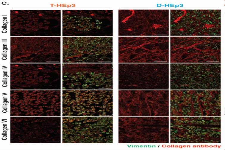 T-HEp3（增殖期腫瘤）和D-HEp3（休眠期腫瘤）的膠原蛋白類型對比（圖源：Nature Cancer）