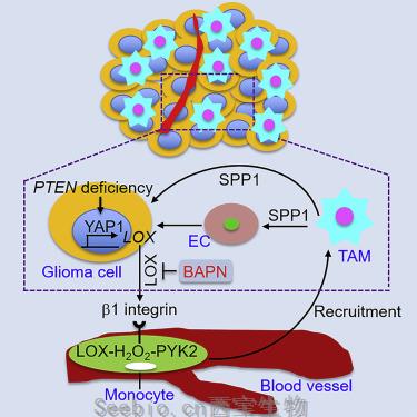 Cancer Cell：揭示巨噬細胞支持PTEN缺陷膠質母<font color='red'>細胞瘤</font>的機制！