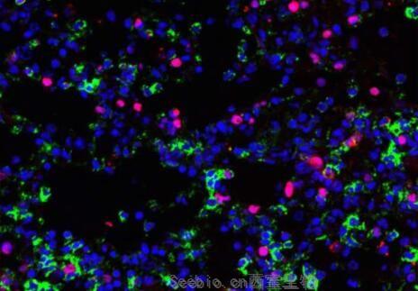 Nat Microbiol：新發現！科學家有望利用脂質靶點開發出新型流感療法