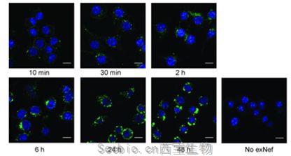 PLoS Pathog：揭示HIV感染如何導致心臟病、<font color='red'>糖尿病</font>和癡呆癥等一系列慢性疾病