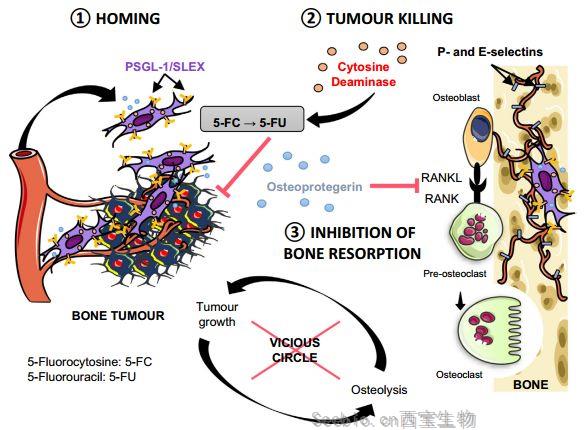 EBioMedicine：研究人員開發(fā)出以骨轉(zhuǎn)移為靶點(diǎn)、同時(shí)保留骨組織的癌癥治療方法