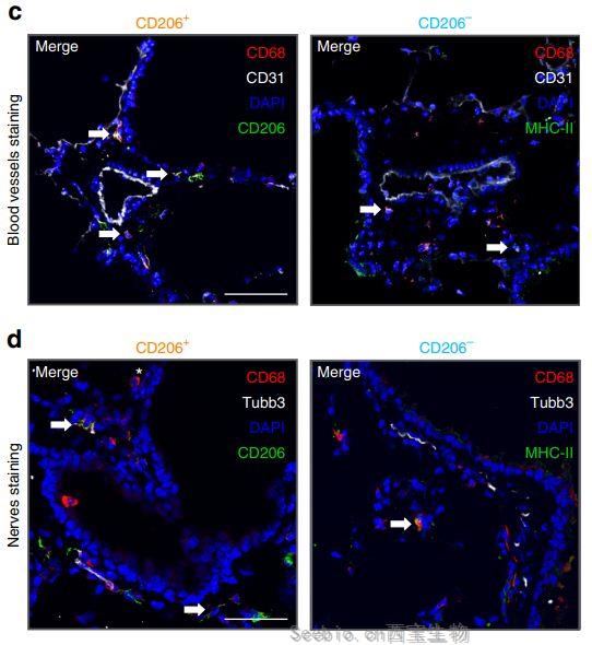 Nat Commu重大突破：發(fā)現(xiàn)全新的肺部免疫細(xì)胞