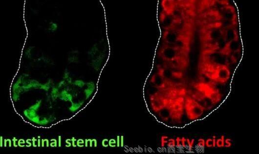 Gastroenterology：關鍵的腸道干細胞基因或能將膳食脂肪與<font color='red'>結腸癌</font>風險聯系起來