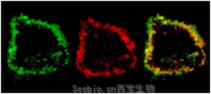 Science子刊：樹突細胞決定著PD-L1阻斷癌癥免疫療法的療效