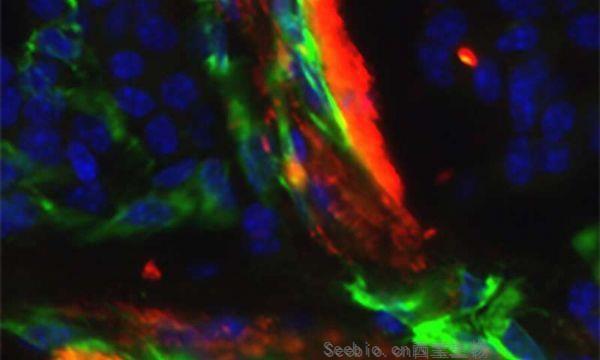 Cancer Res：血小板竟然可以防止癌細胞轉(zhuǎn)移！