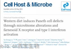 Cell子刊：腸道炎癥、感染的原因找到了，都是披薩漢堡惹的禍！