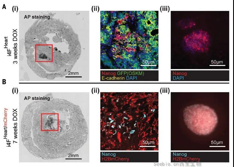 Science重磅：局部重編程讓<font color='red'>心肌細胞</font>“返老還童” 讓心臟實現再生！