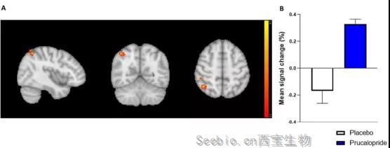 牛津科學家發現：通便也能通記憶，這種藥物或可打造“最強大腦”