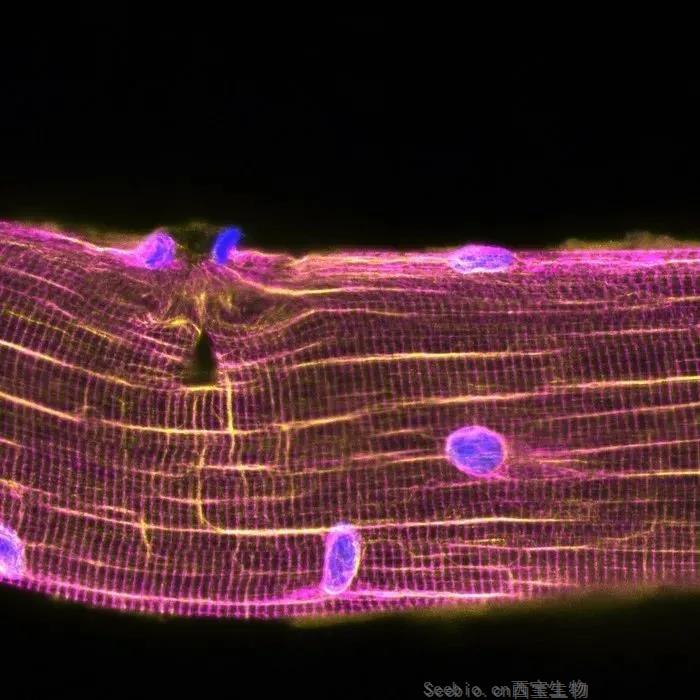 擼鐵過猛肌肉酸痛？別擔心，Science揭示受損肌肉自我修復的秘密