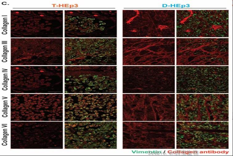 讓癌細(xì)胞“一睡不醒”！向腫瘤微環(huán)境中添加III型膠原蛋白可防止腫瘤復(fù)發(fā)和轉(zhuǎn)移