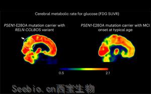 Nature Medicine發現了新的<font color='red'>基因變異</font>，可以預防阿爾茨海默病