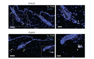 IL-17蛋白對皮膚老化的關鍵作用