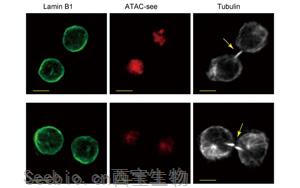 是什么決定了CD8+ T細胞的命運？Immunity新研究指向cBAF復合物