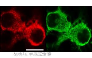 《PNAS》從過度反應蛋白合成到認知障礙，敲除1個基因即可