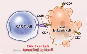 劃時代！首個堿基編輯CAR T療法挽救兩名白血病兒童生命