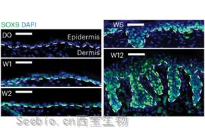 Nature子刊新研究為癌癥如何破壞干細胞精心調整的表觀過程提供了新見解