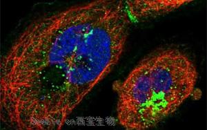 《Cell》有潛力戰(zhàn)勝阿爾茨海默氏癥的蛋白質(zhì)，還能延長(zhǎng)壽命