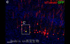 《Neuron》科學家發現腦力更新的生物標志物