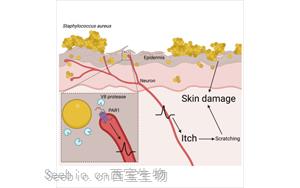 Cell：首次證明一種常見的皮膚細(xì)菌可以通過直接作用于神經(jīng)細(xì)胞而引起<font color='red'>瘙癢</font>