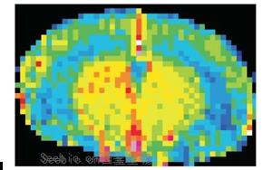 Nature Neuroscience：一種免疫蛋白可能誘發(fā)與高血壓無關(guān)的癡呆