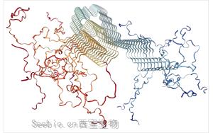 PNAS：一種新的檢測方法有望早期發現<font color='red'>帕金森病</font>