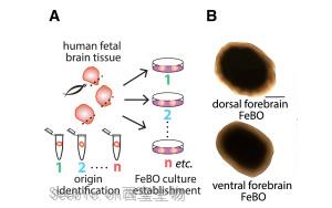 《Cell》新型組織衍生的大腦<font color='red'>類器官</font>可能會給大腦研究帶來革命性的變化
