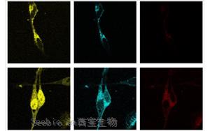 PNAS：脂肪酸調節脂質生物合成的新途徑