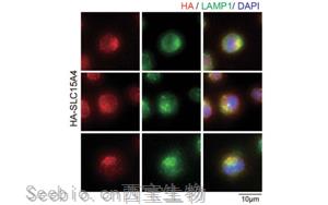 Nature子刊：開創性的將化學探針引入活細胞，靶向紅斑狼瘡