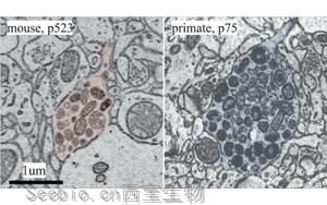 大腦什么時候長大?新發(fā)現震驚神經科學家