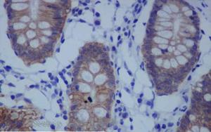 《PNAS》一種不為人知的蛋白質，它能保持人體細胞的健康