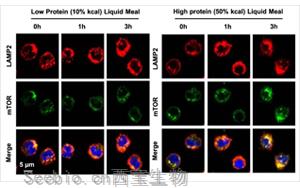 Nature子刊亮氨酸暴露實驗證明高蛋白飲食如何使你的動脈硬化