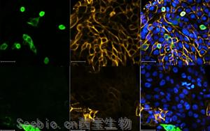 Nature最新研究表明，一類新的抗病毒藥物可以對抗SARS-CoV-2