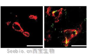 Nature子刊：肝臟中的免疫細胞會對高膽固醇水平做出反應(yīng)，并吃掉多余的膽固醇