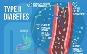 Nature Medicine：2型糖尿病的多祖先多基因機(jī)制