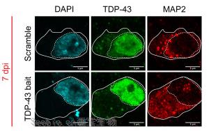 Cell Stem Cell：利用<font color='red'>類器官</font>保護癡呆和ALS中受到的腦損傷